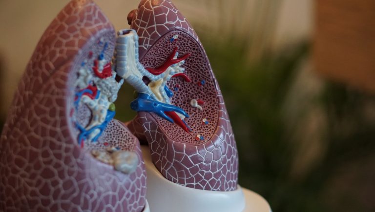 Cancer du poumon : de nouvelles données d&rsquo;Esmo qui prolongent la vie des patients