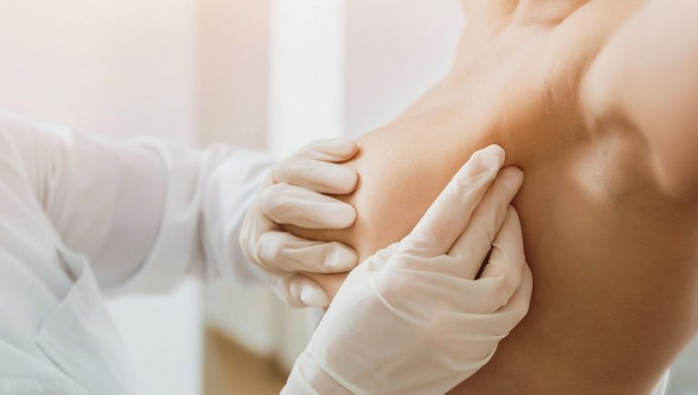Cancer du sein à un stade précoce : nouvelles données sur un traitement réduisant le risque de récidive