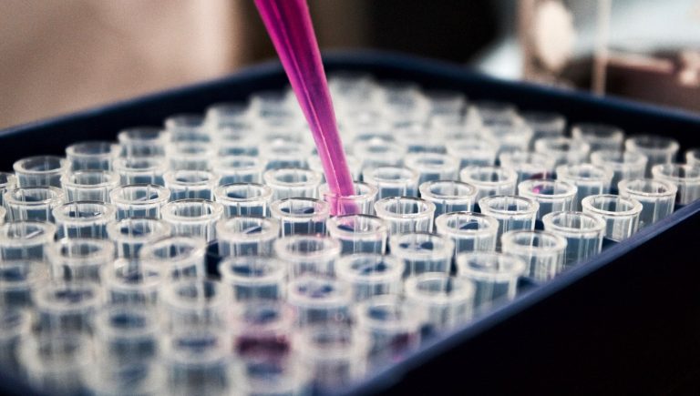 Mélanome, voici comment l&rsquo;immunothérapie cible les métastases cérébrales