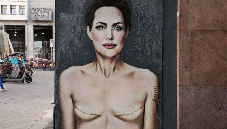 « Mutation Angelina », qu&rsquo;est-ce que c&rsquo;est et comment elle a changé le traitement des tumeurs du sein et de l&rsquo;ovaire