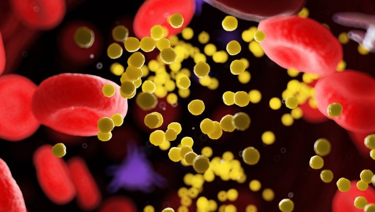 Cholestérol LDL, quand et qui a besoin de super médicaments pour le réduire (rapidement) à des niveaux minimaux