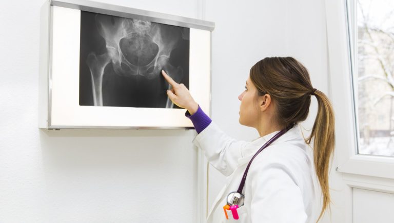 Comment traiter le sarcome d&rsquo;Ewing, le cancer des os qui touche les jeunes