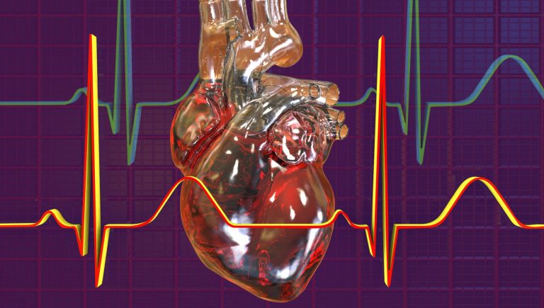 Fibrillation auriculaire : l&rsquo;hypertension, le diabète et les kilos en trop augmentent le risque