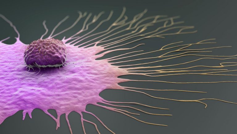 Cancer du sein : cibler les cellules « dormantes » pour prévenir les récidives