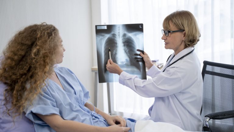 Cancer du poumon, oui l&rsquo;immunothérapie après chirurgie est efficace