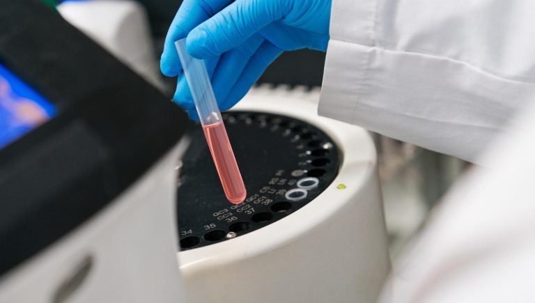 Maux de ventre et gonflement abdominal : une prise de sang peut aider à diagnostiquer un cancer