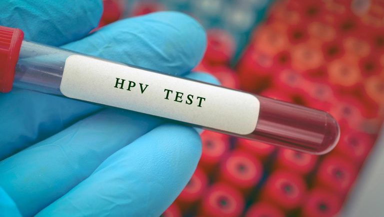 Les Italiens en savent encore trop peu sur le VPH et le cancer du col de l&rsquo;utérus