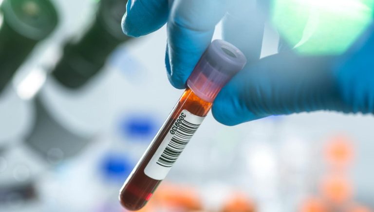 Myélome multiple, comment gérer la tumeur qui revient