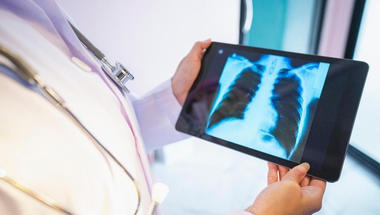 À Bologne, nous parlons de l&rsquo;avenir des thérapies contre le cancer du poumon