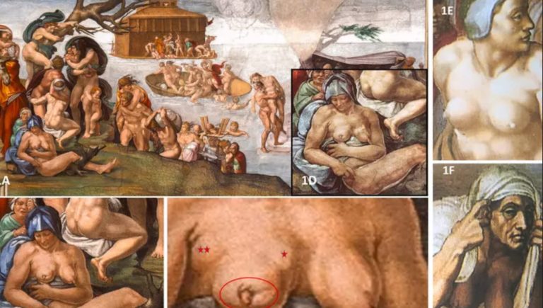 Cancer du sein, la maladie dépeinte par Michel-Ange dans la Chapelle Sixtine