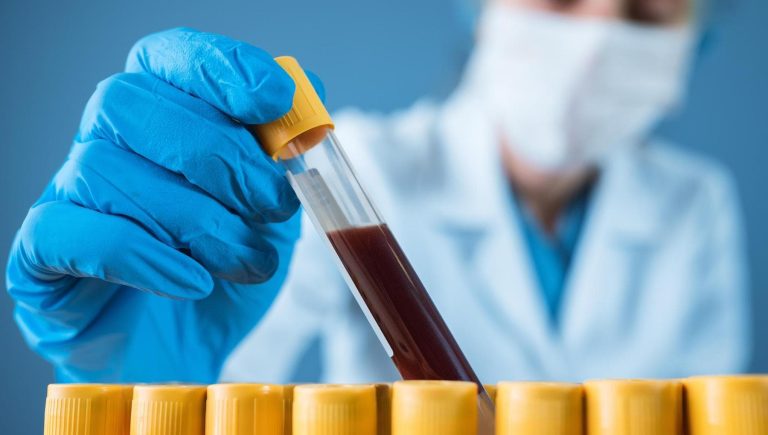 Cancer colorectal, le saura-t-on grâce à une prise de sang ?