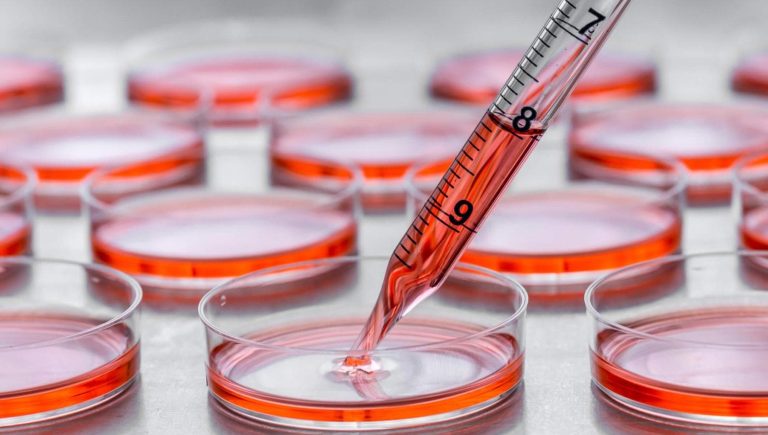 Cancer du sein, la biopsie liquide utile pour accéder à des traitements innovants