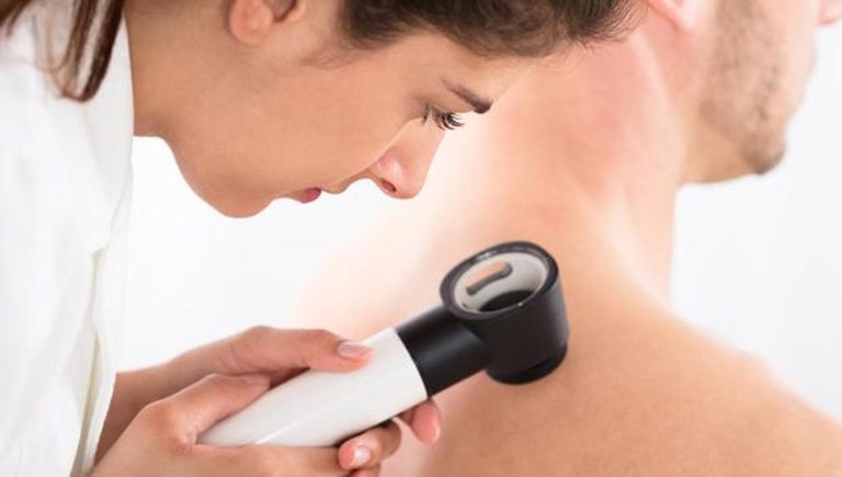 Mélanome, les diagnostics augmentent de 30% en 2024
