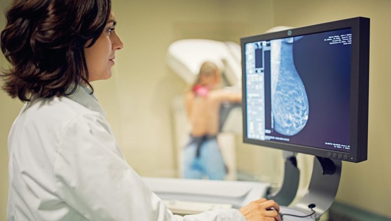 Intelligence artificielle dans le dépistage du cancer du sein: où sommes-nous?