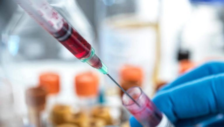 Cancer du sein métastatique, thérapies ciblées grâce à la biopsie liquide, mais peu y en accèdent