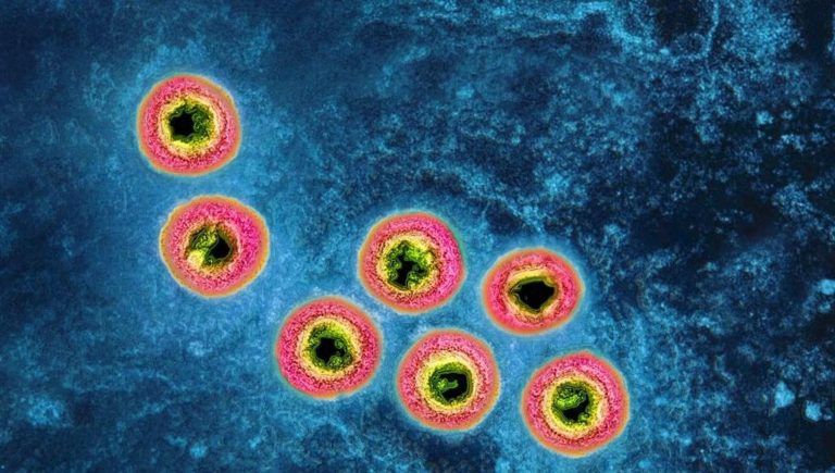 Herpès Zoster, chez ceux qui vaccinent moins de risque de crise cardiaque, d&rsquo;accident vasculaire cérébral et d&rsquo;insuffisance cardiaque