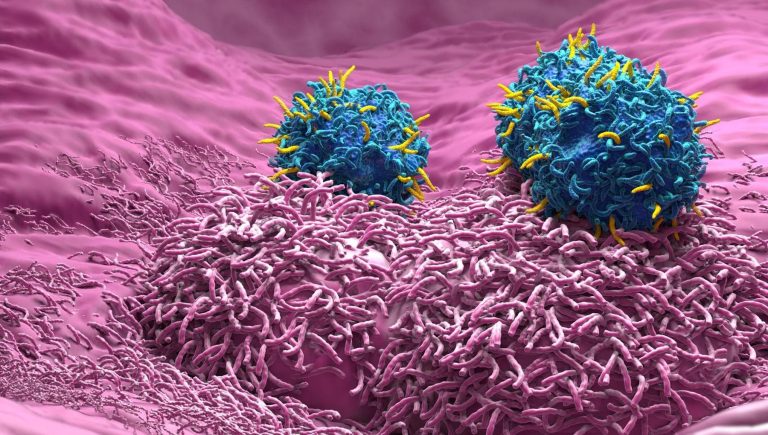 Vers une thérapie CAR-T contre les métastases du cancer colorectal