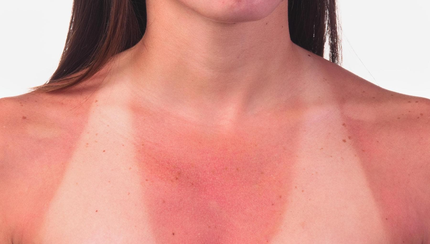Apporter votre peau est un message. Et raconte le malaise des jeunes