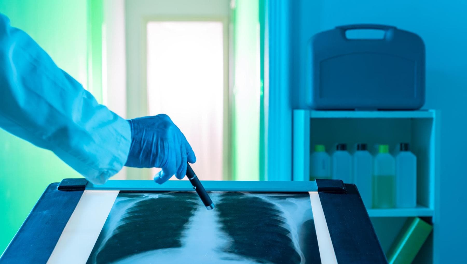 Cancer du poumon, le robot «photographe» également très petit et révolutionne le diagnostic précoce