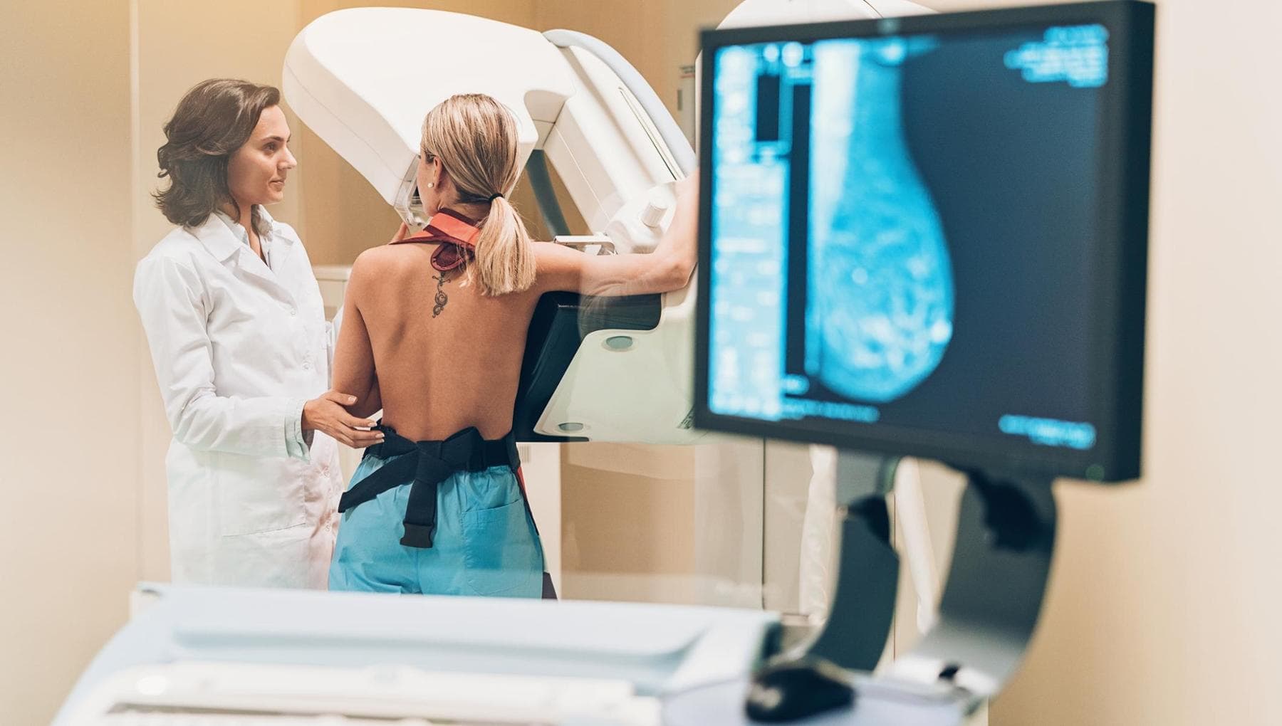 Cancer du sein, une raison de plus de ne pas "sauter" la première mammographie
