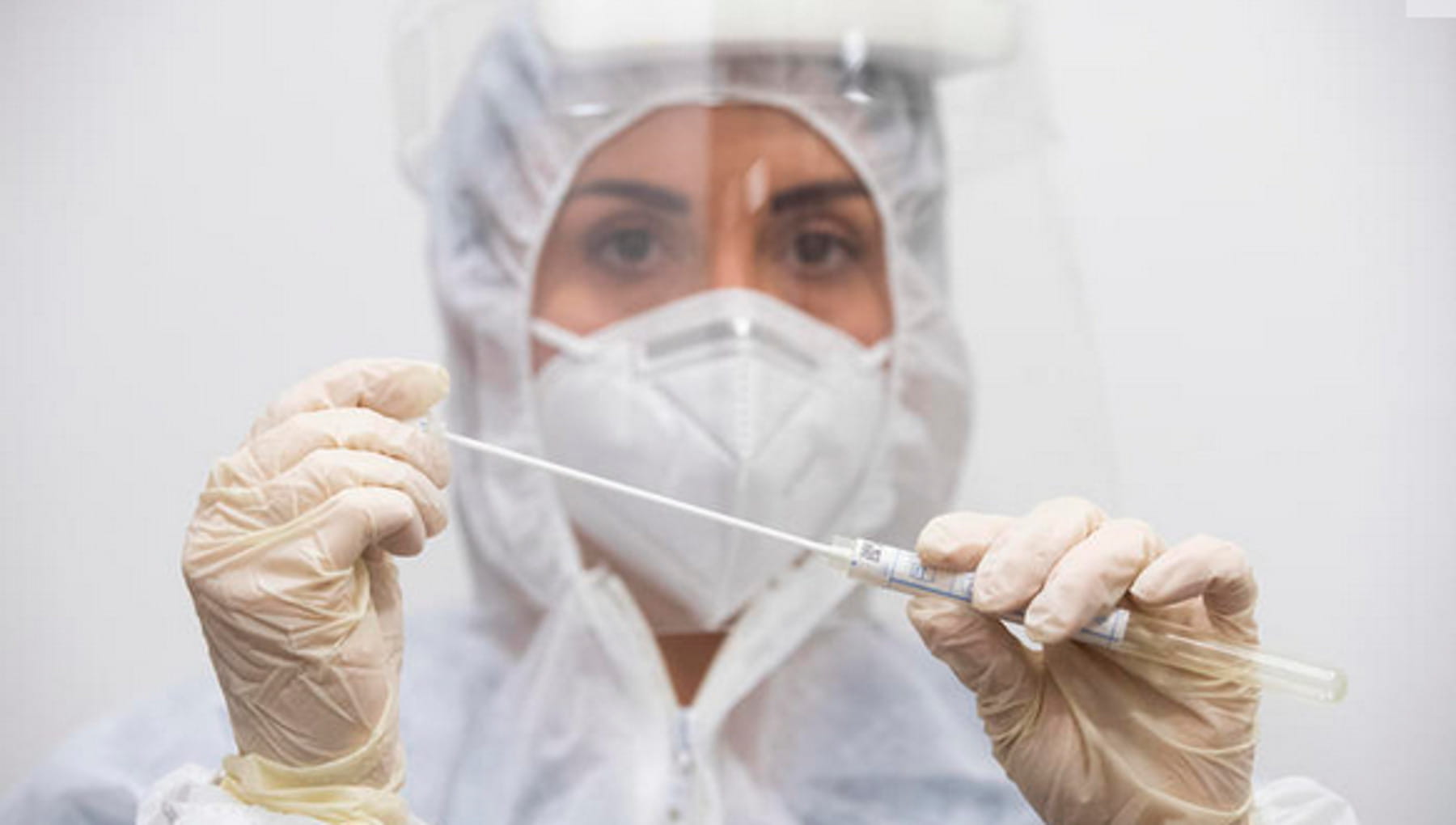 Covide, cas enregistré d'un homme avec VIH: l'infection a duré 2 ans