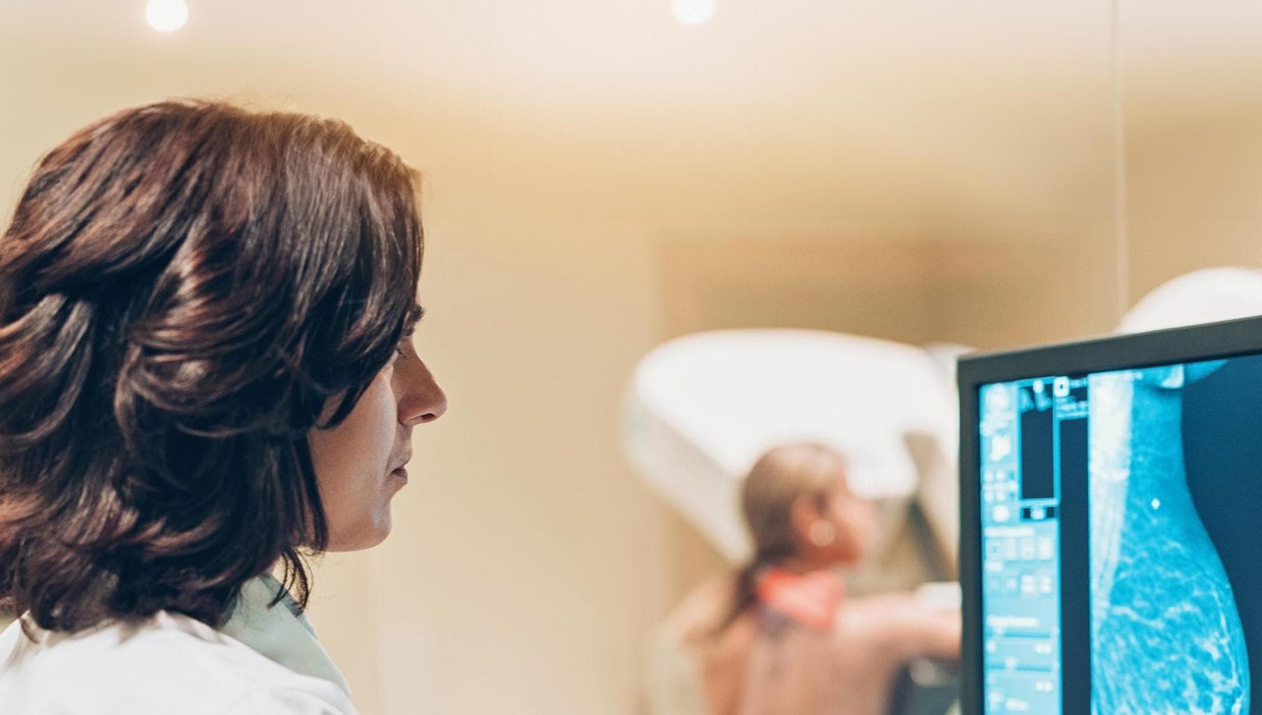 Mammographie plus intelligence artificielle: le test "deux en un" dira le risque de crise cardiaque