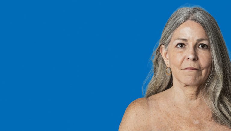 Dépistage mammographique : vers une extension de 45 à 74 ans dans toute l&rsquo;Italie
