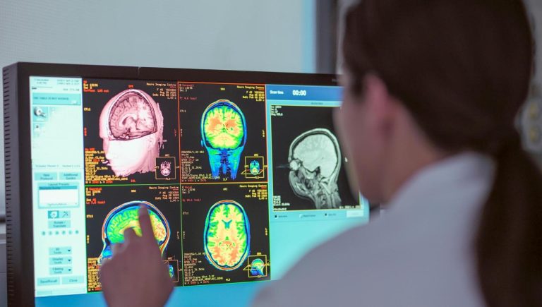 Gliomes, un diagnostic et un traitement de plus en plus précis