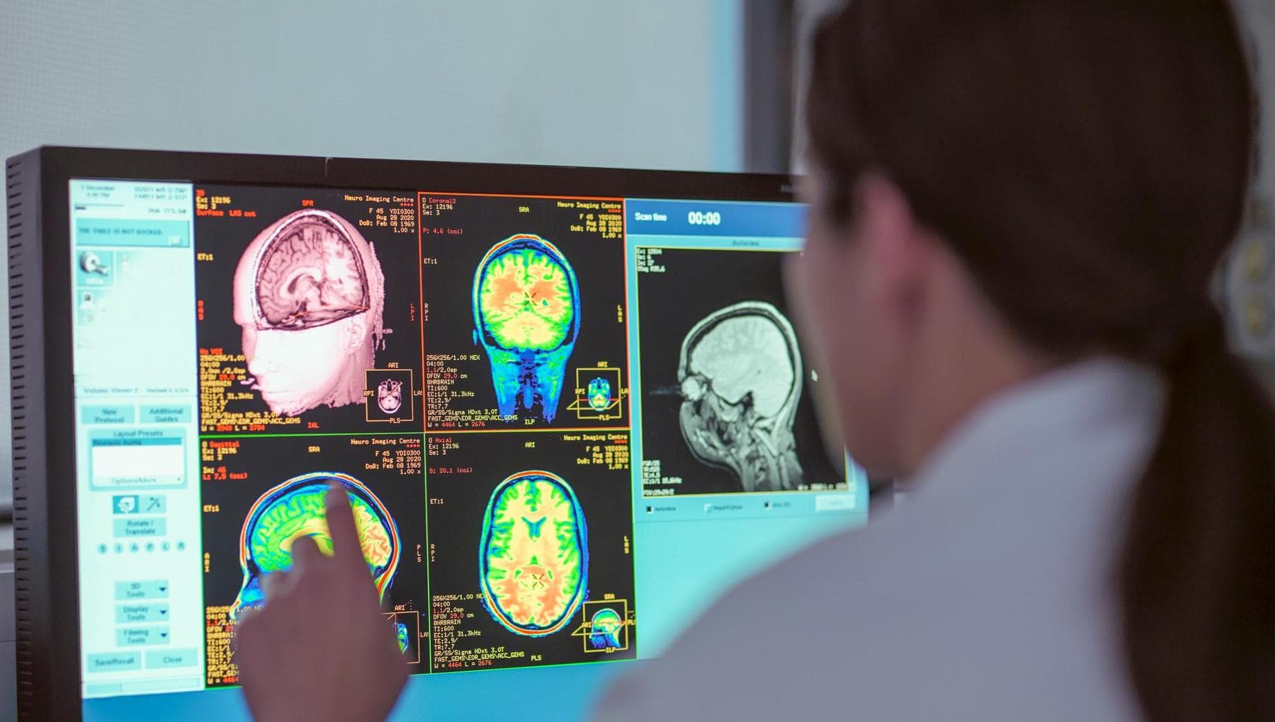 Gliomes, un diagnostic et un traitement de plus en plus précis