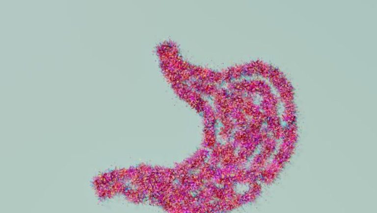 Tumeur gastrique, diagnostic difficile mais les nouveaux soins changent le scénario