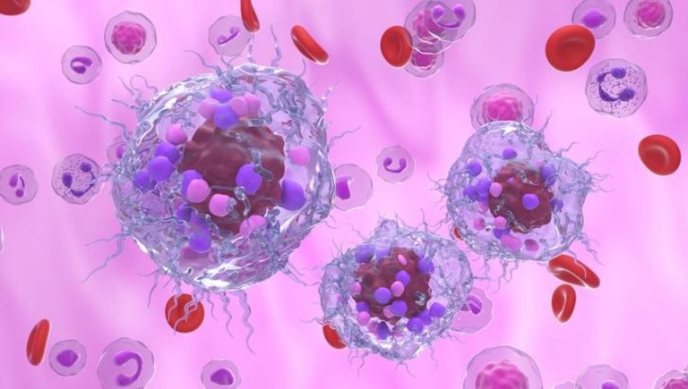Tumeurs neuroendocrines : une nouvelle thérapie réduit le risque d&rsquo;aggravation de 81 %.