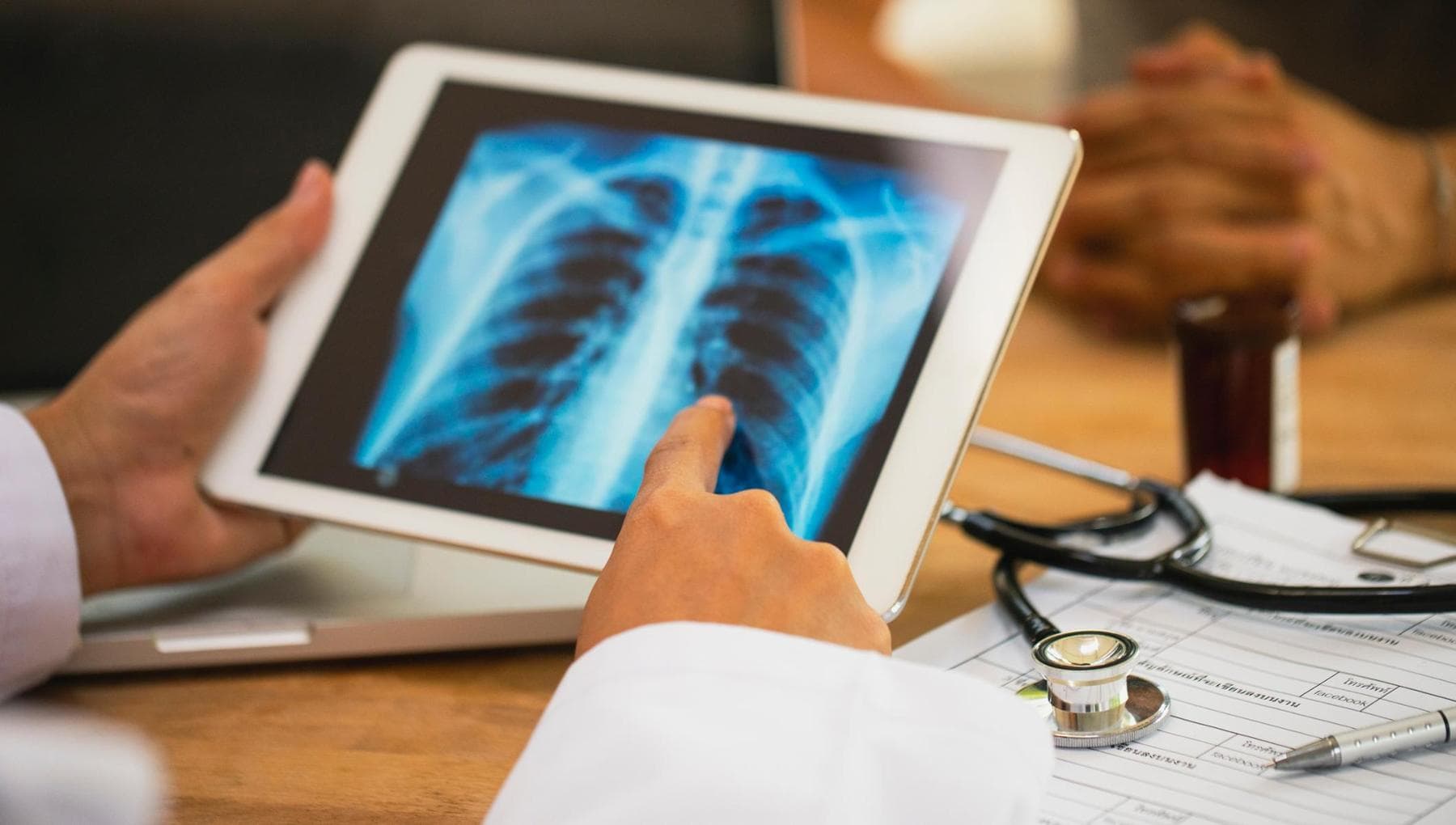 Une thérapie ciblée contre le cancer du poumon remporte le prix Galen 2025 pour ses résultats dans ce domaine