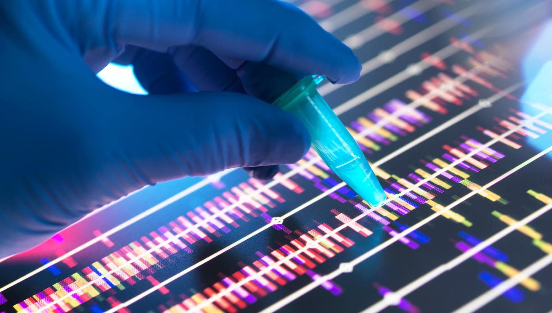 Tests génomiques pour 13 000 femmes en Italie. Bianchini (San Raffaele): « Agrandir le fonds »