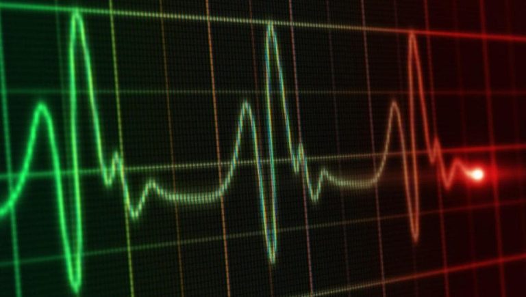 Dépistage des crises cardiaques et des accidents vasculaires cérébraux, quand commencer ? Voici le bon âge pour elle et lui