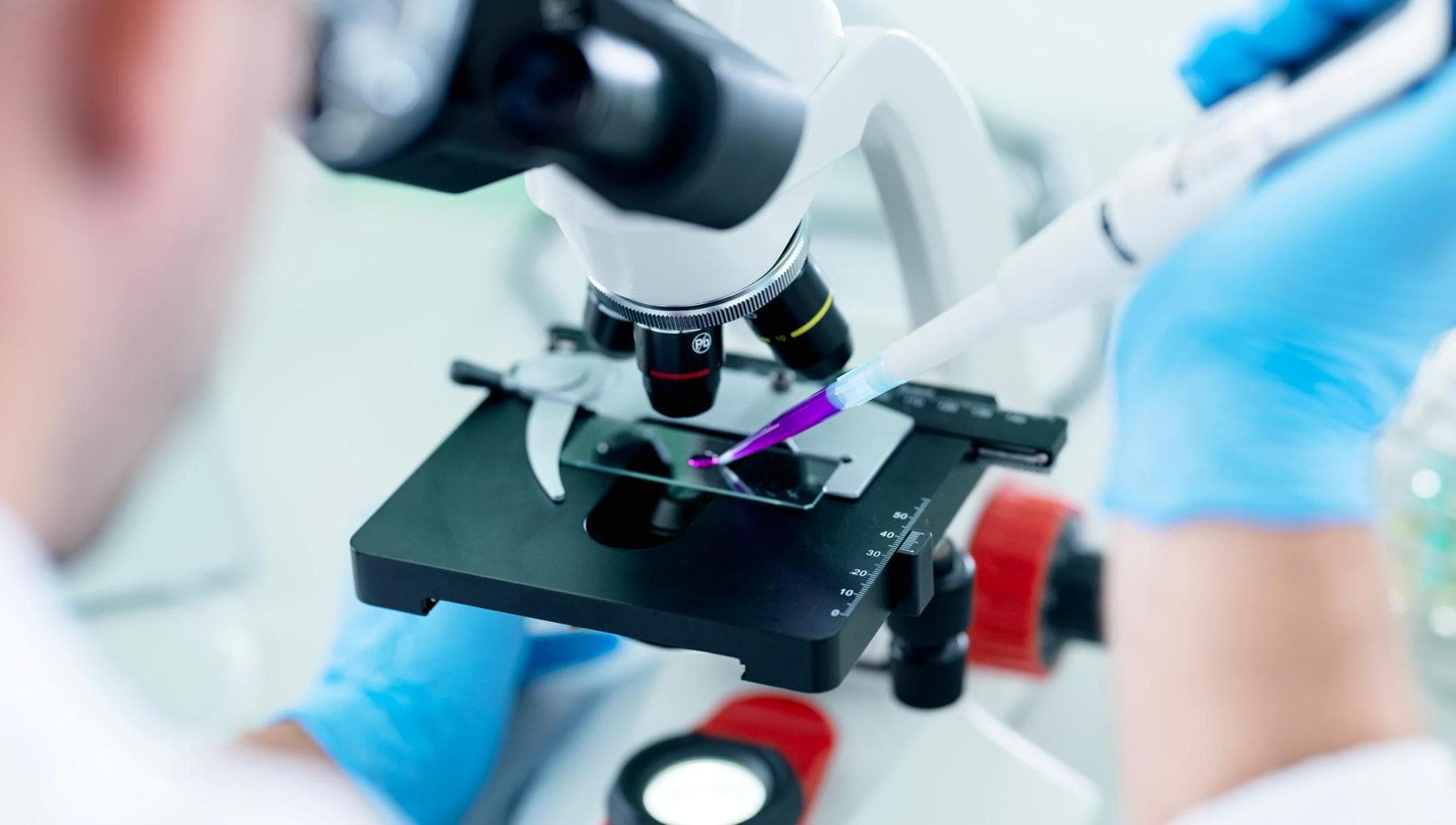 Lymphome folliculaire : grâce à la chimio-immunothérapie, près de la moitié des patients parviennent à guérir