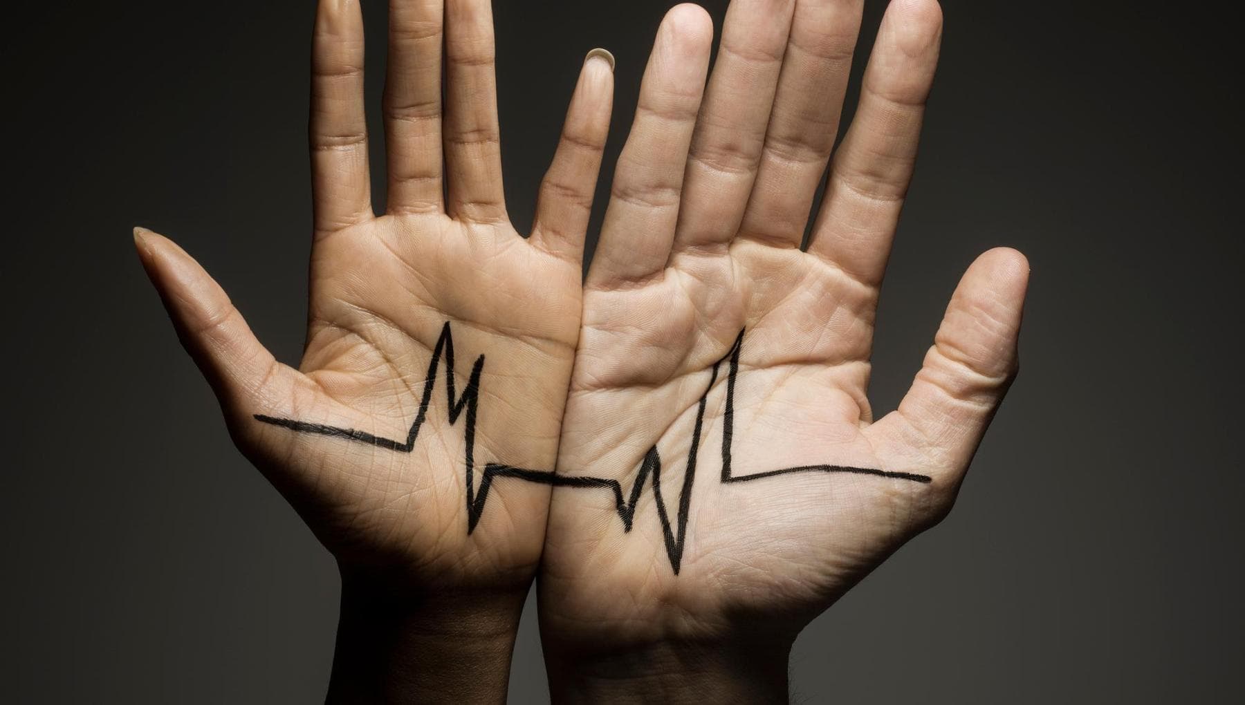 Cancers, les femmes survivent plus longtemps que les hommes, mais avec des effets secondaires plus graves