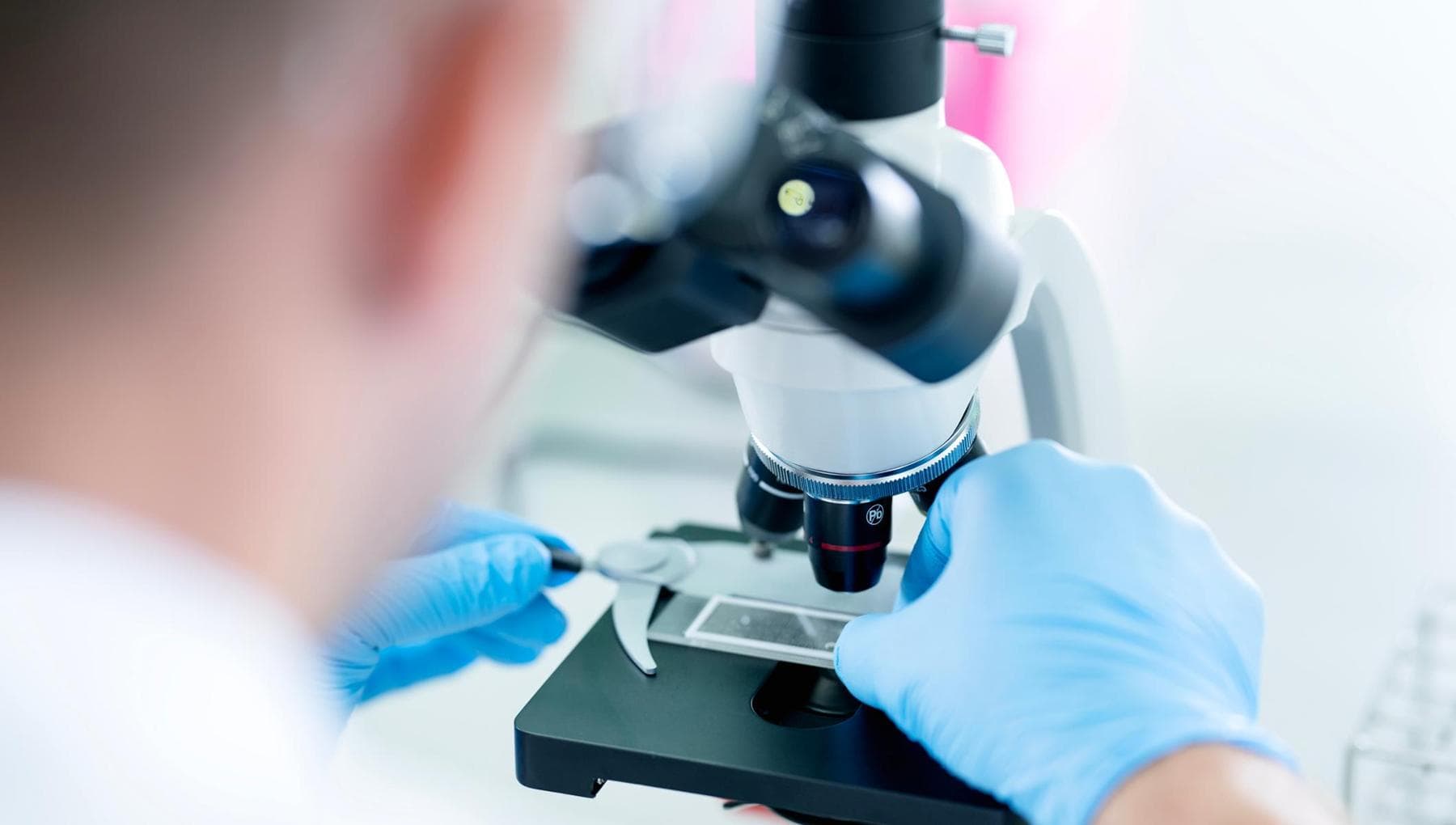 Cancer du sein, la recherche italienne découvre un nouveau « frein » moléculaire.