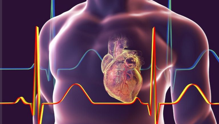 Après une crise cardiaque ou un accident vasculaire cérébral, des contrôles et des thérapies ciblées protègent le cœur et le cerveau