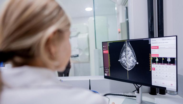 Cancer du sein triple négatif : il existe une nouvelle thérapie