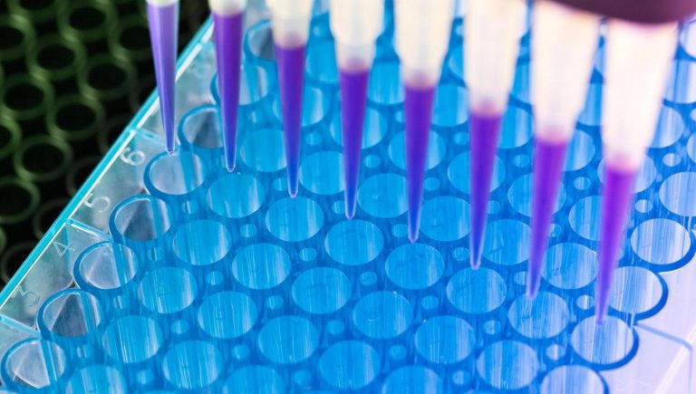 Tumeur de Pacreas : un nouveau test de diagnostic précoce dans le sang à l&rsquo;étude