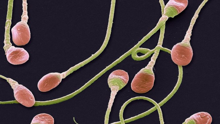 A 10 ans il congèle du tissu testiculaire avant une chimio : 16 ans après un spermatozoïde. Première fois