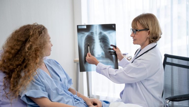 Cancer du poumon, les 10 choses que les femmes devraient savoir


