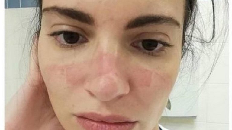 L&rsquo;infirmière sur la photo symbolique du Covid : « La réintégration des anti-vax est une blessure à la mémoire »