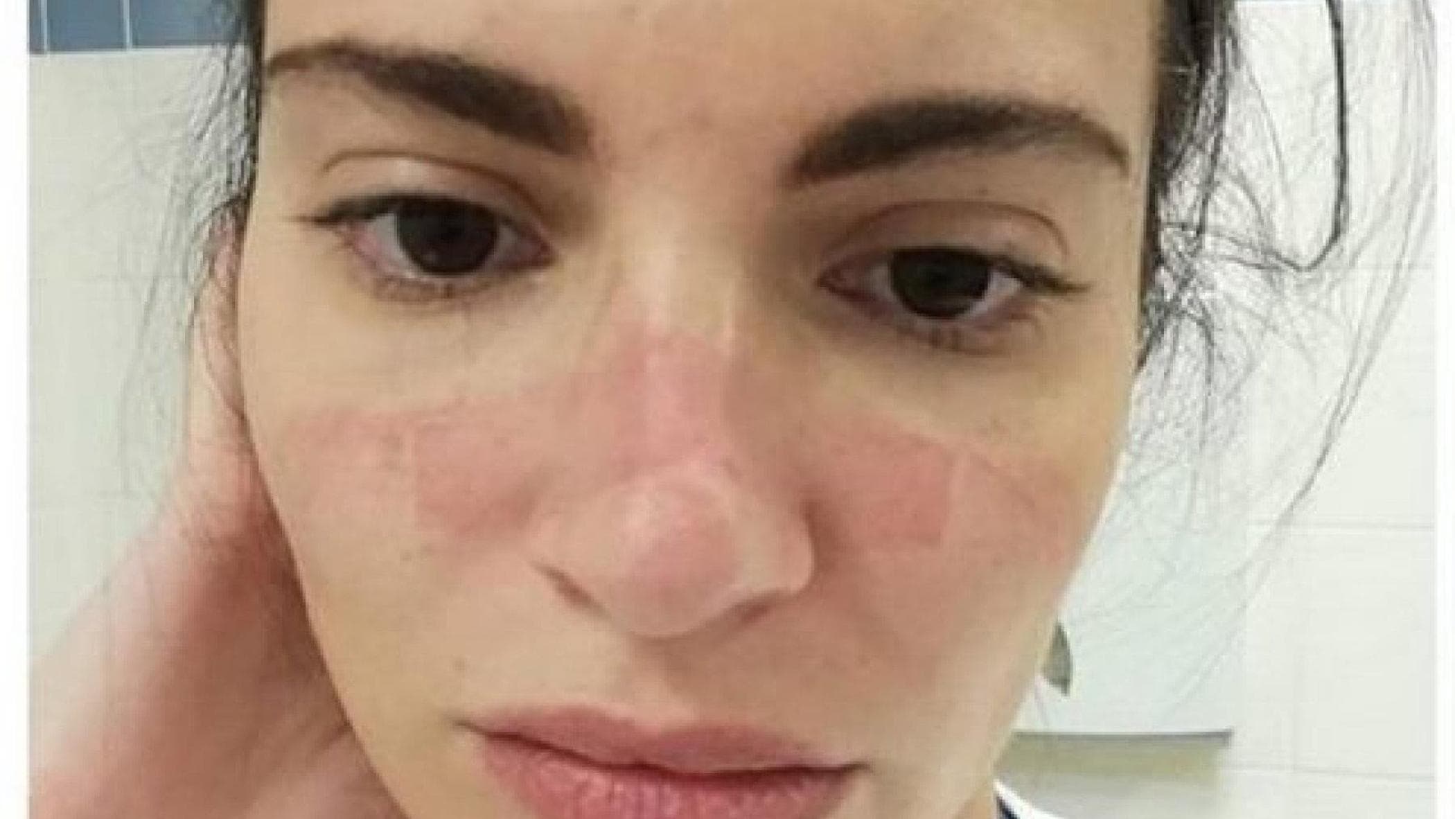 L'infirmière sur la photo symbolique du Covid : "La réintégration des anti-vax est une blessure à la mémoire"