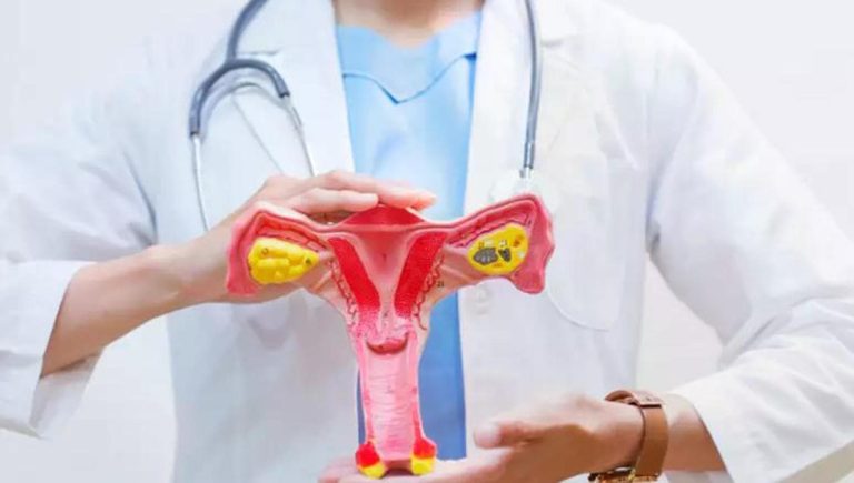 Suppression d&rsquo;une tumeur ovarienne de 15 kilos avec une patiente éveillée