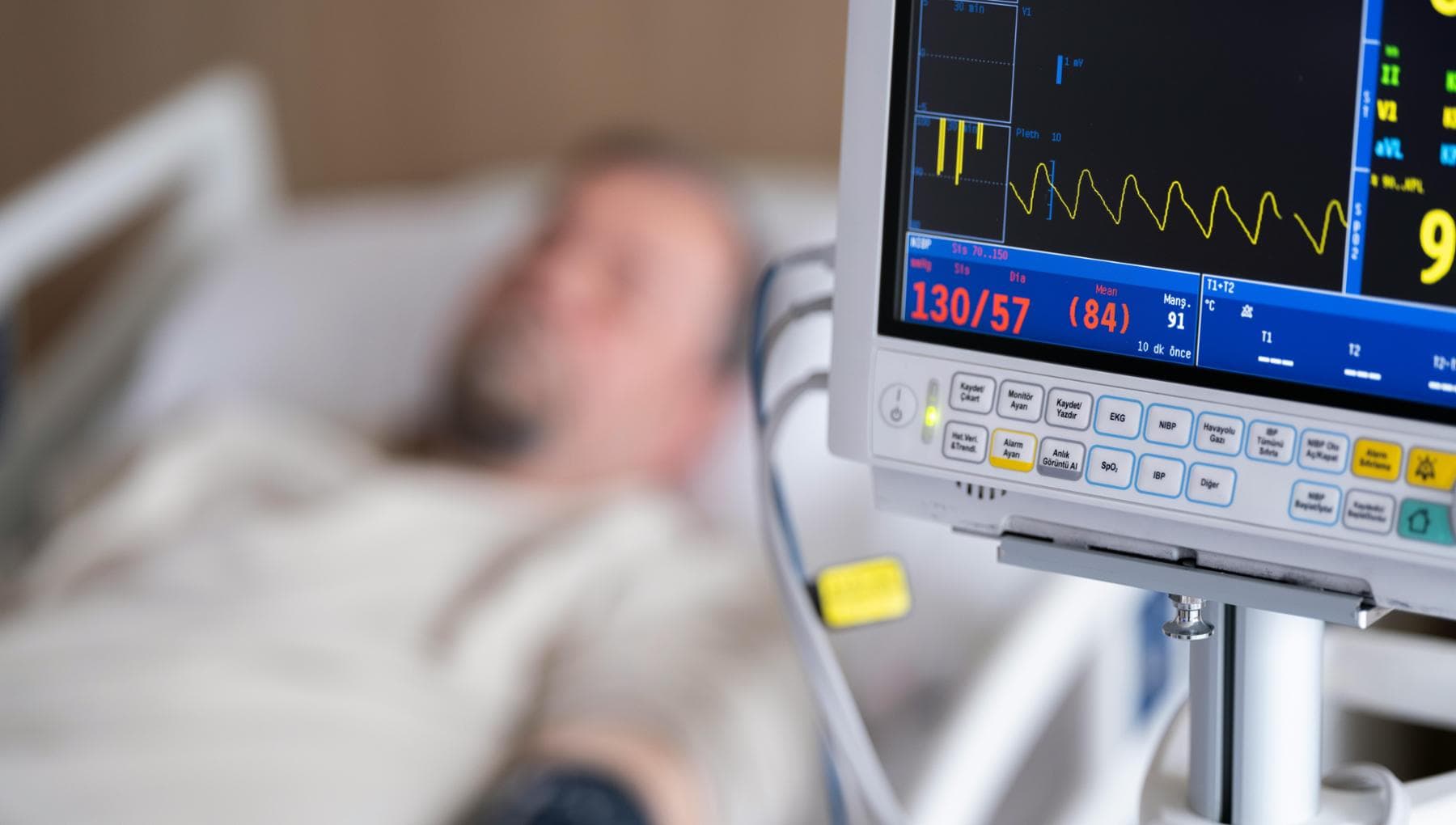 AVC après un diagnostic de cancer : risque 2,5 fois plus élevé au cours des trois premiers mois