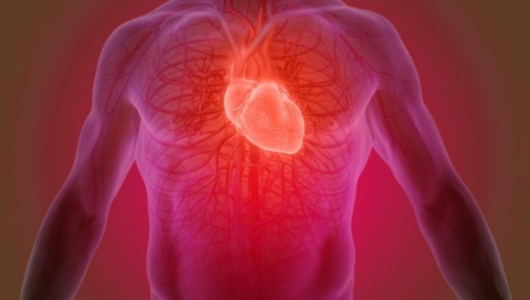 Crise cardiaque aiguë, voici l'analyse 3D qui permet de comprendre pour quelles artères le stent est nécessaire


