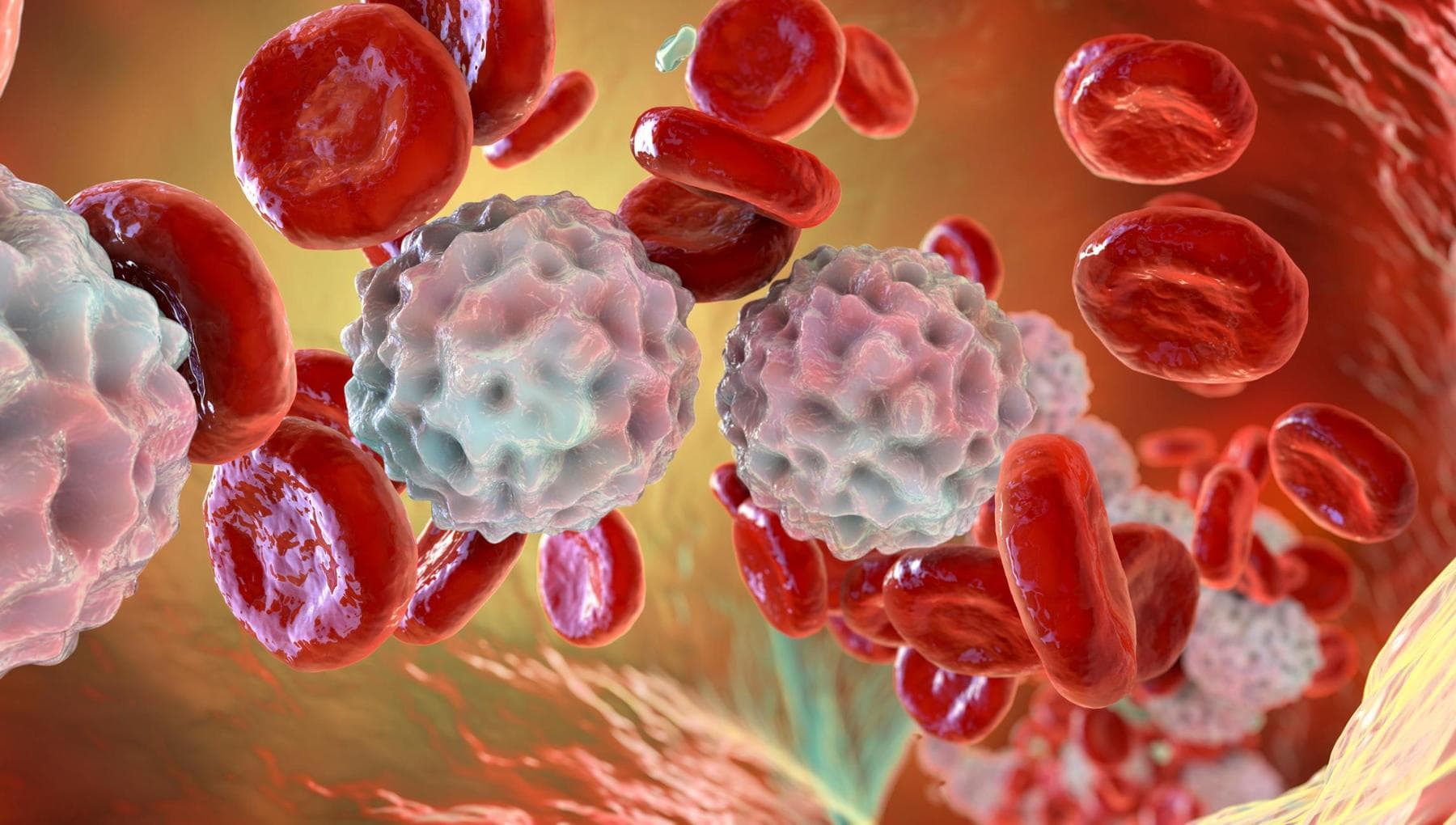 Le lymphome diffus à grandes cellules B, une nouvelle option pour les cas plus graves