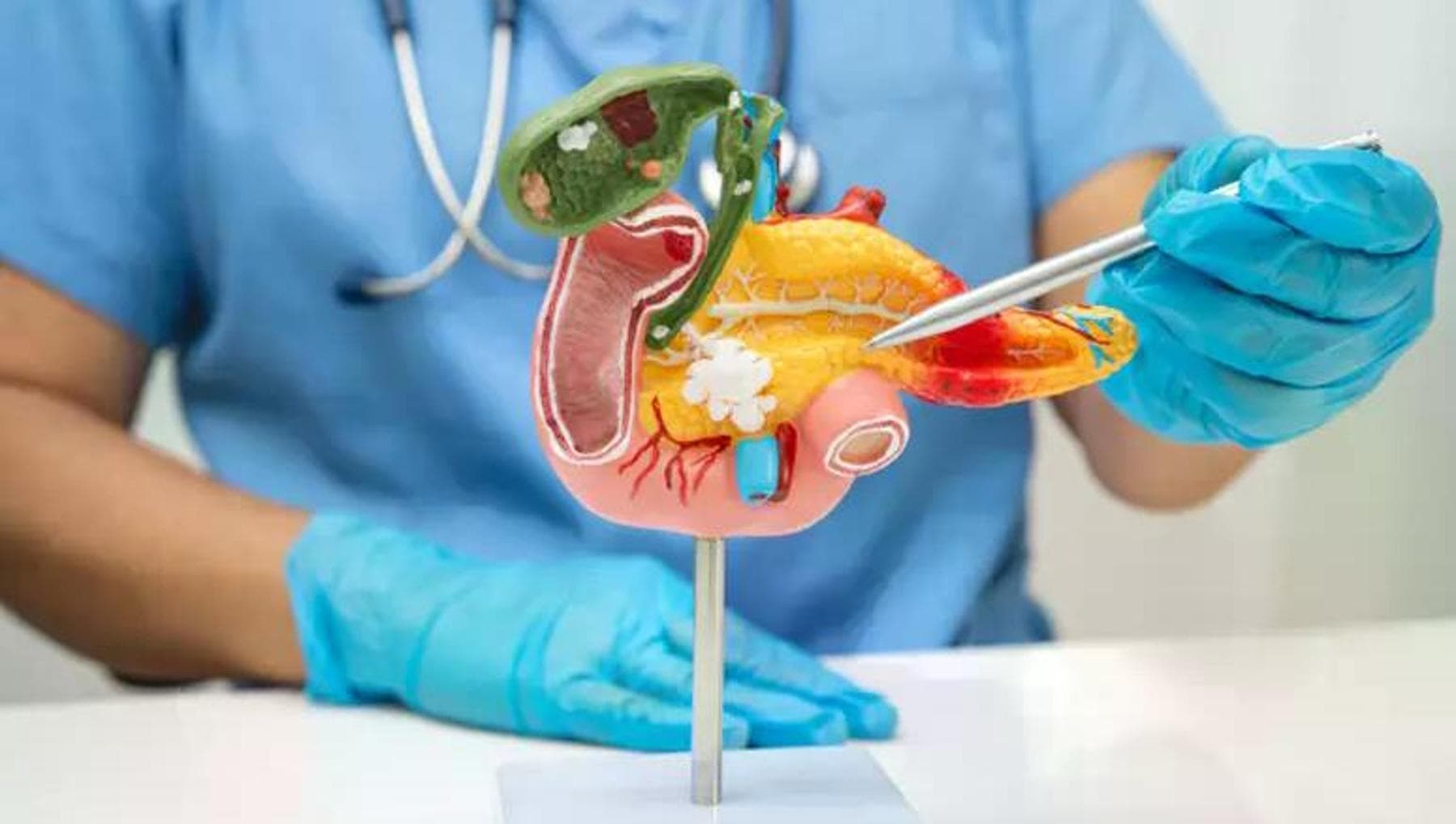 Attaque du pancréas, la tumeur la plus effrayante aux yeux de la science