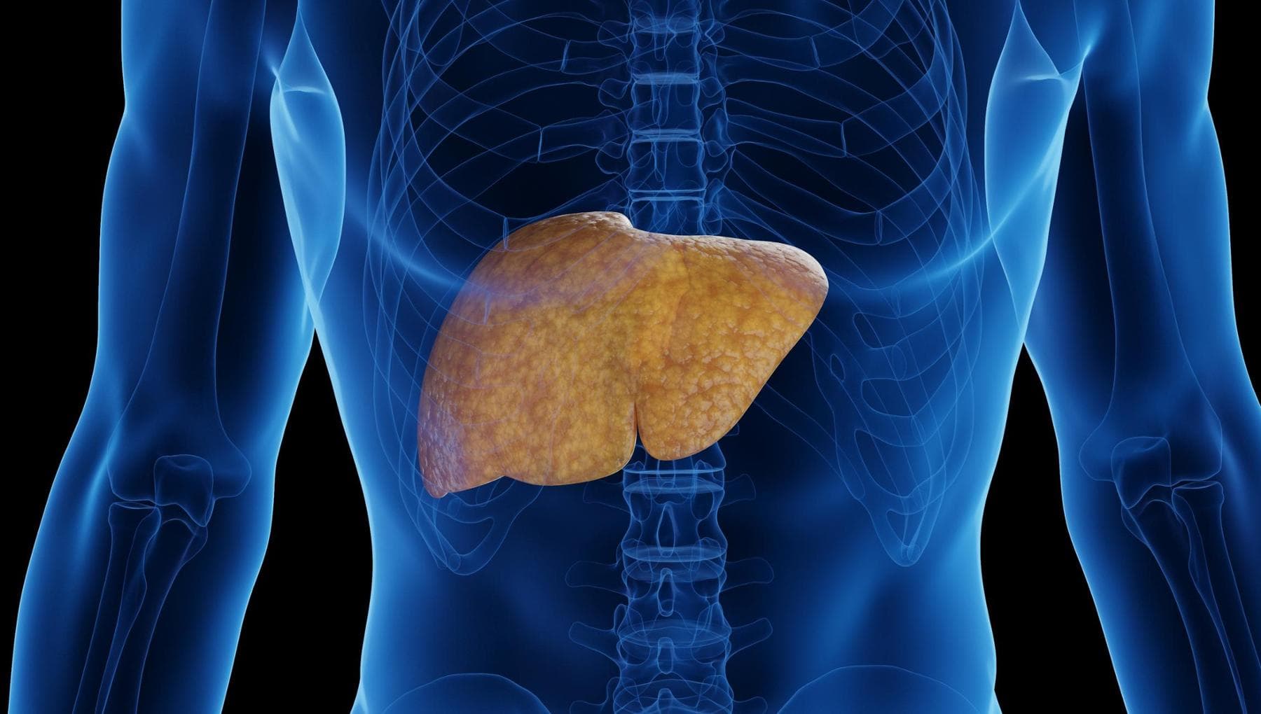 Cancer du foie avancé, un patient sur six vivant à six ans grâce à l'immunothérapie